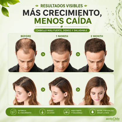 Shampoo Anticaida Hair Care Disaar